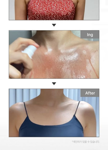 medicube - Red Acne Body Peeling Shot, 110g, 165 g, 8800240576233