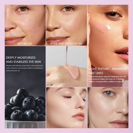 RoyueS - Blackcurrant Plump Hyaluronic Serum, 75ml, 115 g, 6951286421192