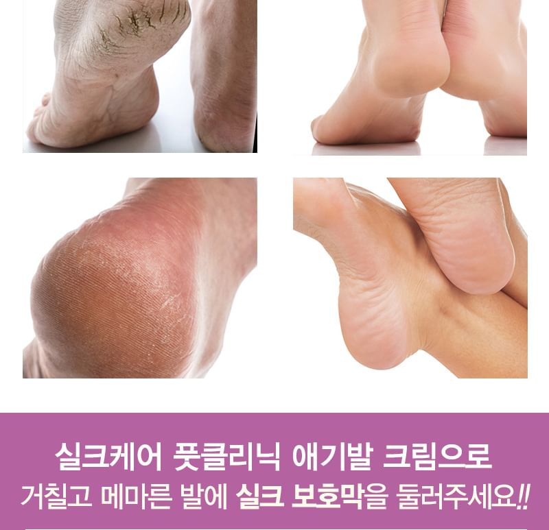 TOSOWOONG - Foot Cream, 2023 Version - 100ml, 130 g, 8809179103473