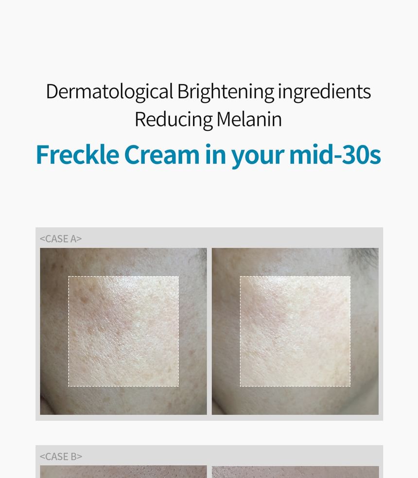 Dr.Melaxin - TX Cream, 50ml, 70 g, 8809886481413