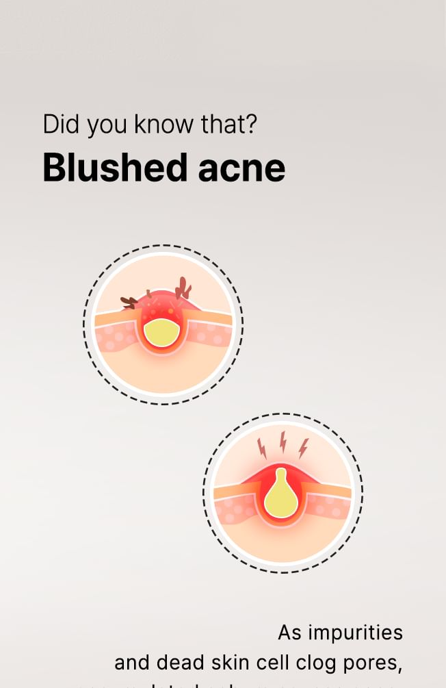 ALIVE:LAB - Enrich Salicylic Acid 0.5% Cleanser, 170ml, 207 g, 8809083977641