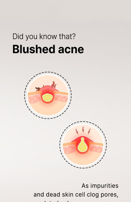 ALIVE:LAB - Enrich Salicylic Acid 0.5% Cleanser, 170ml, 207 g, 8809083977641