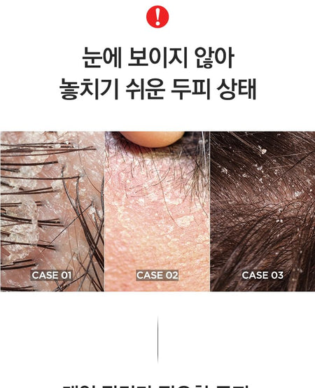 TOSOWOONG - Kelp Shampoo, 500ml, 1000 g, 