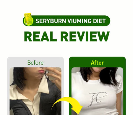 SERY BOX - Seryburn Viuming Diet, 10.5g x 14 sticks, 200 g, 8802863131271