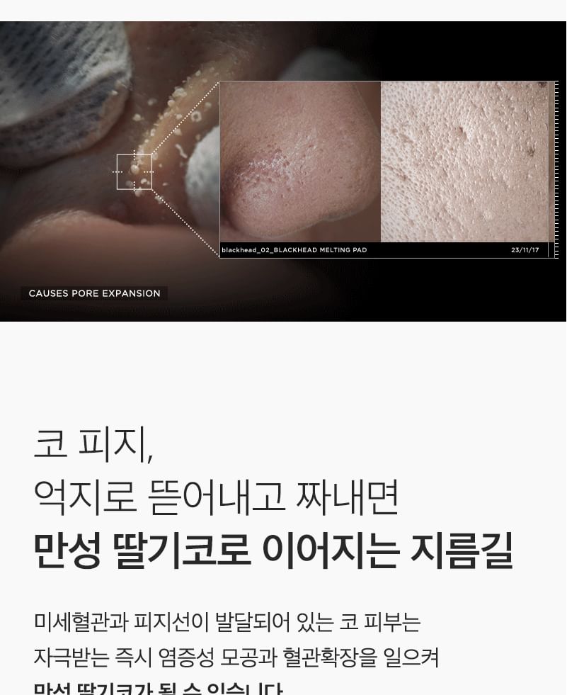 MONSTER FACTORY - Blackhead Melting Pad, 30 pads, 170 g, 8809665918048