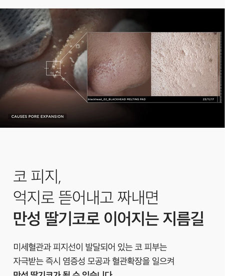 MONSTER FACTORY - Blackhead Melting Pad, 30 pads, 170 g, 8809665918048
