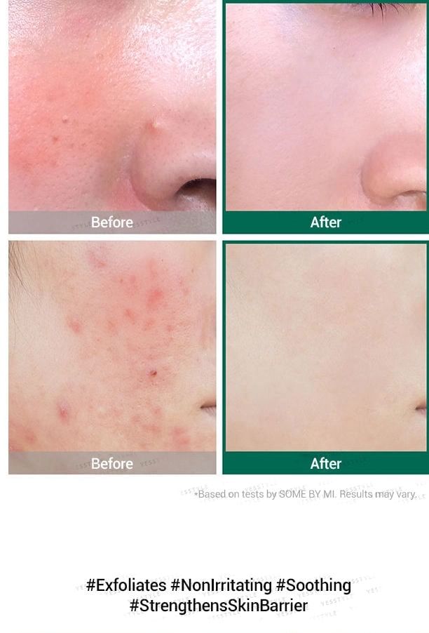 SOME BY MI - AHA, BHA, PHA 30 Days Miracle Serum 50ml, 50ml, 115 g, 8809525242764