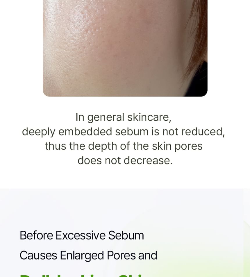 RETURNU - Pore Shooter Ampoule, 30ml, 74 g, 8809810320252