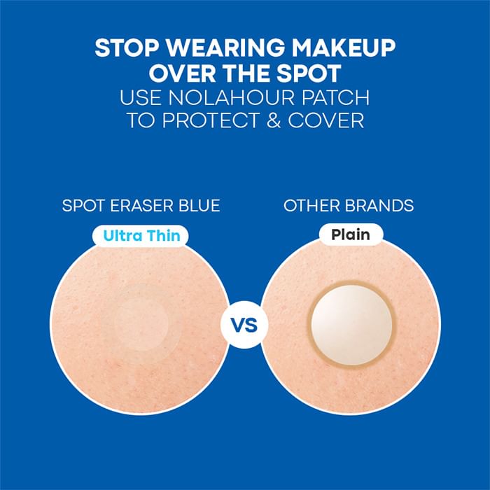 NOLAHOUR - Spot Eraser Blue, 63 patches, 50 g, 8809800000294